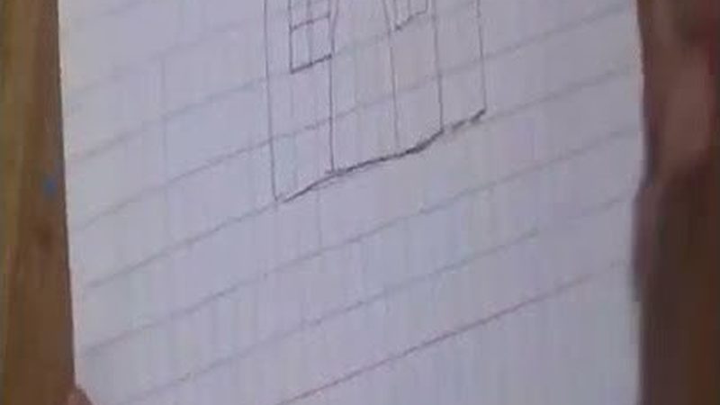 单颗种植牙加盟，品牌选择有哪些关键因素？**