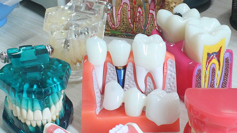 牙周炎洗牙能彻底治愈吗？洗牙治疗误区解析**